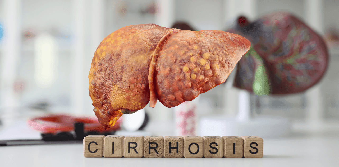 Liver Cirrhosis