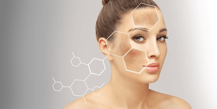 Skin Hyperpigmentation: What Causes the Disorder?
